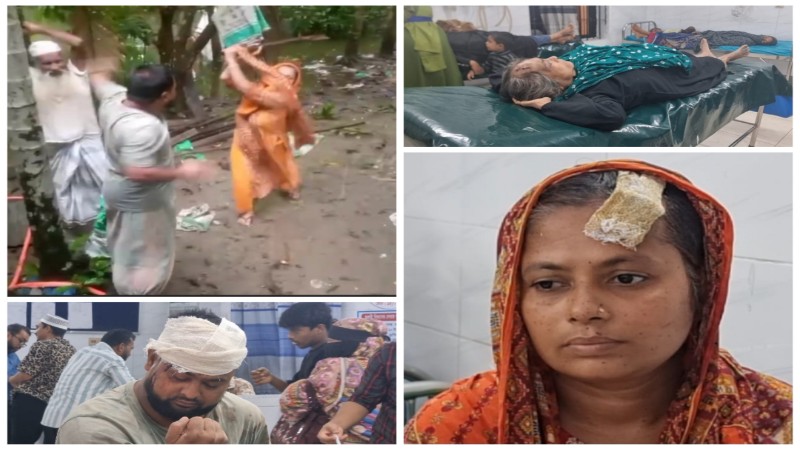 হাইমচরে সম্পত্তি বিরোধে সাংবাদিক পরিবারের ওপর হামলা, আহত ৫, আটক ২