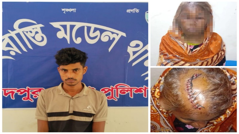 শাহরাস্তিতে টাকার জন্য মায়ের মাথায় জখম, মাদকাসক্ত ছেলে আটক